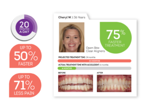 Graphic showing how Acceledent Optima speeds up treatment